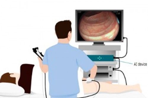 生6个月「废功」20%癌症检出率！pg电子中国柳叶刀惊曝：AI让医(图9)